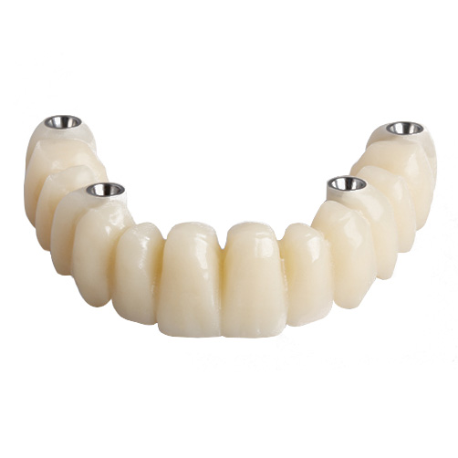 ArgenIS PMMA Multi-Shade Bridge from Newcraft Dental Arts